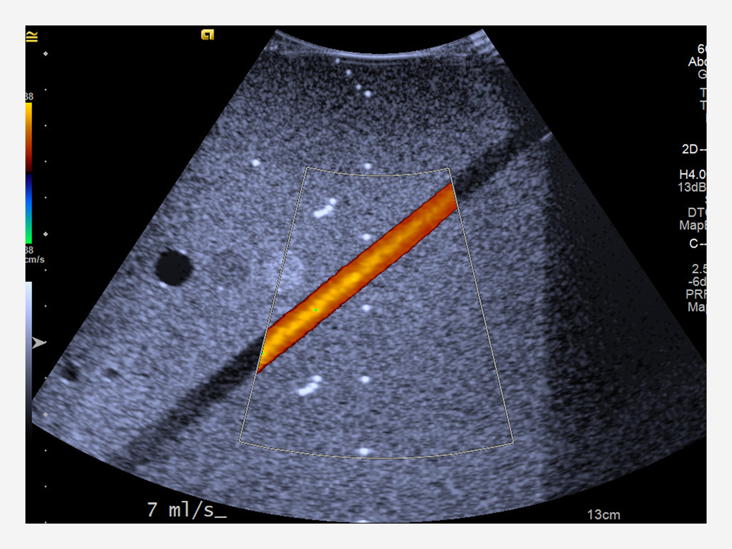 Doppler Ultrasound Phantoms