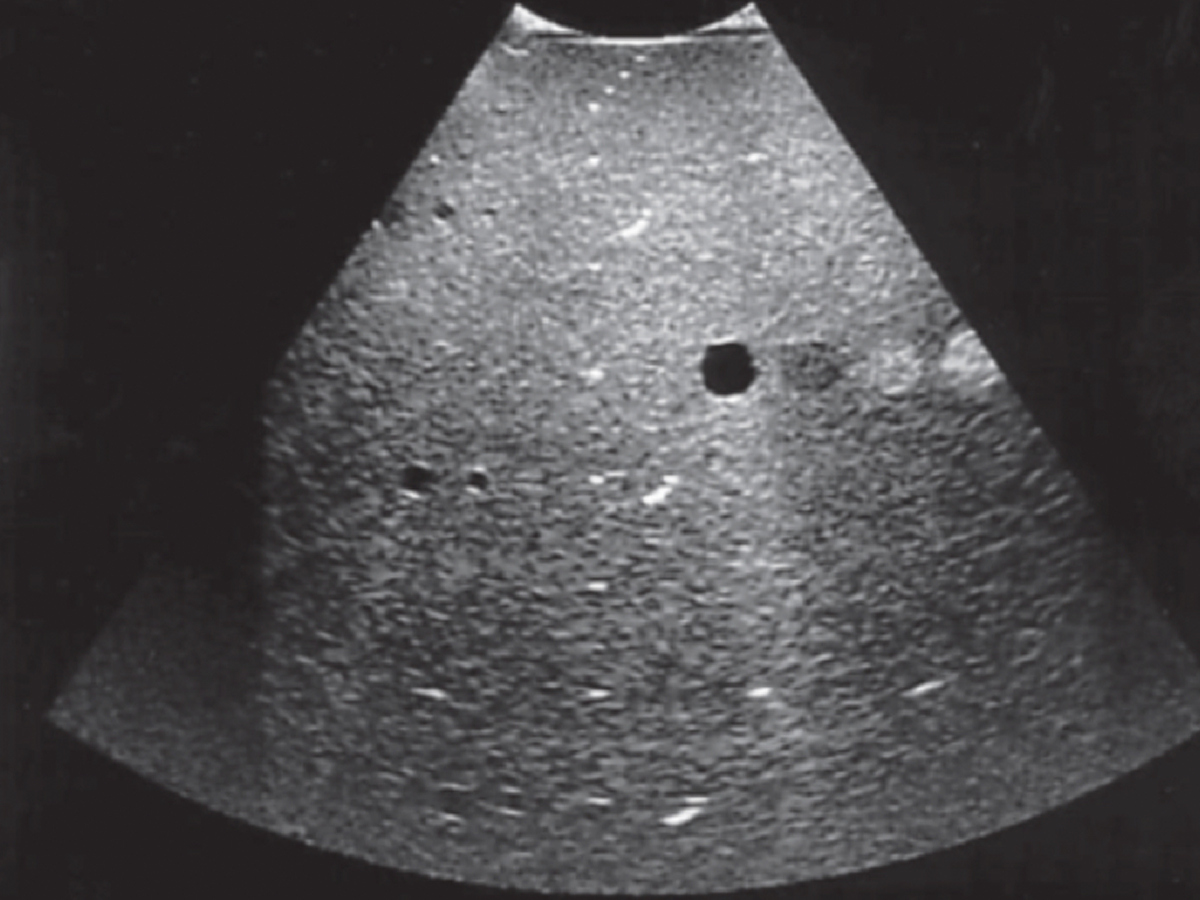 Prostate brachytherapy transrectal ultrasound imaging workshop for medical physicists